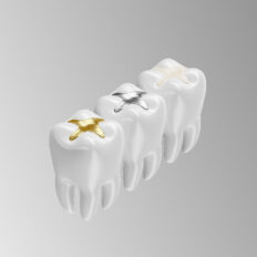 Tooth-Colored Fillings